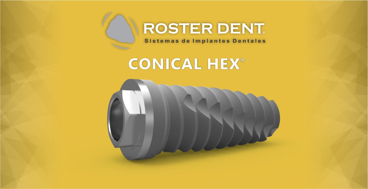 Rosterdent - Conical Hex SG